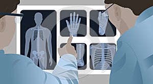 doctors examining an x-ray of the chest, hands, feet of the patient in the x-ray .